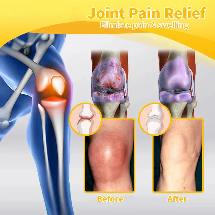 💧🇦🇺Official Store: flysmus™ Bee-Venom Pain-Relief Bone Healing Cream👨⚕️Therapeutic Goods Administration (TGA) Certified