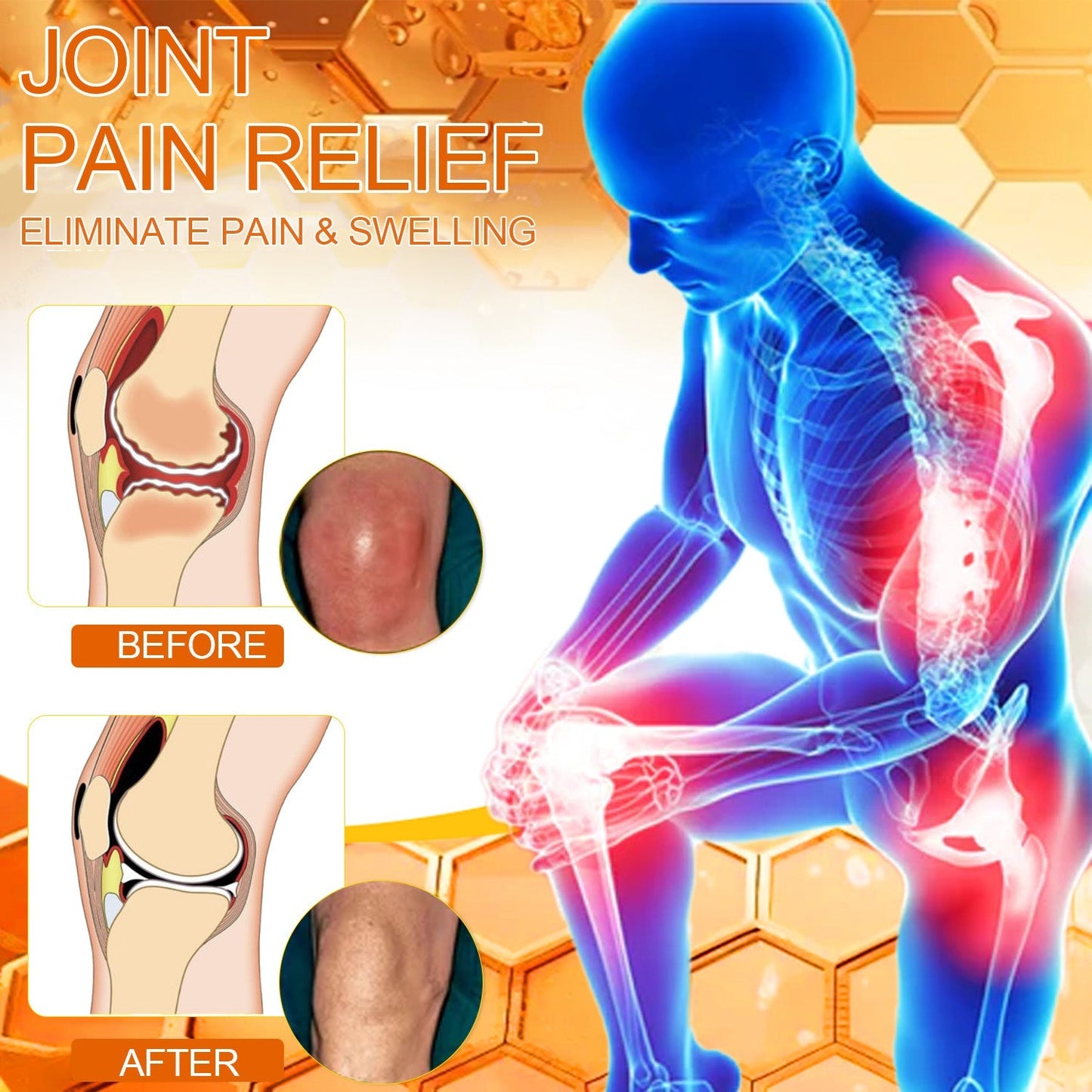 š„Aetheris⢠Bee Venom Instant Ultra Strength Pain Relief Therapy Cream