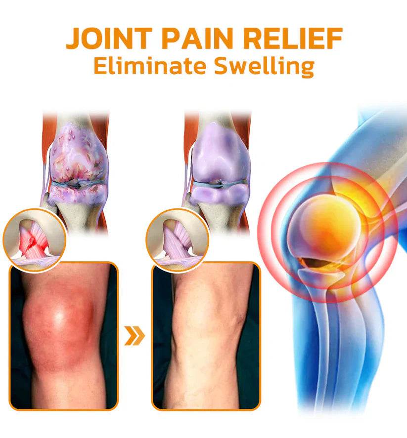💧🇦🇺Official Store: flysmus™ Bee-Venom Pain-Relief Bone Healing Cream👨⚕️Therapeutic Goods Administration (TGA) Certified