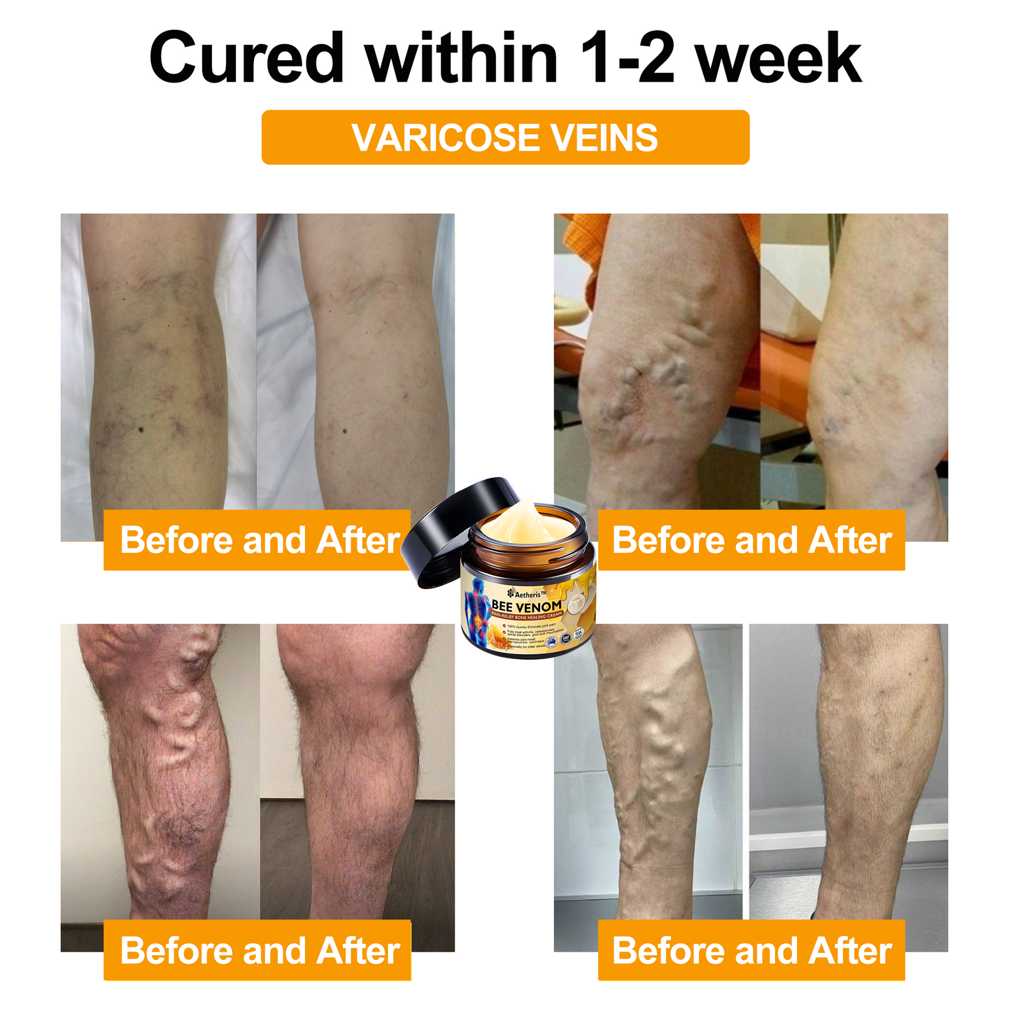 š„Aetheris⢠Bee Venom Instant Ultra Strength Pain Relief Therapy Cream