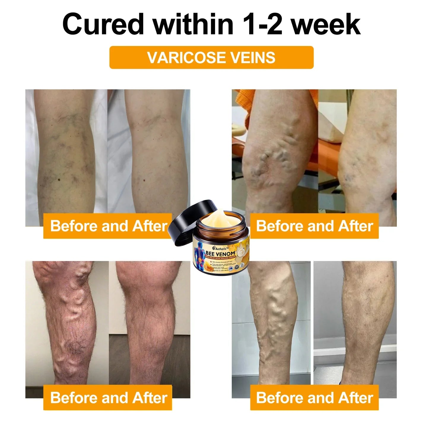 ❤️🔥Aetheris™ Bee Venom Instant Ultra Strength Pain Relief Therapy Cream🇦🇺(ARA Approved)