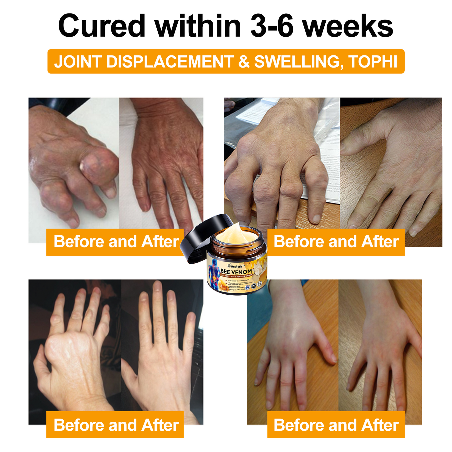 š„Aetheris⢠Bee Venom Instant Ultra Strength Pain Relief Therapy Cream