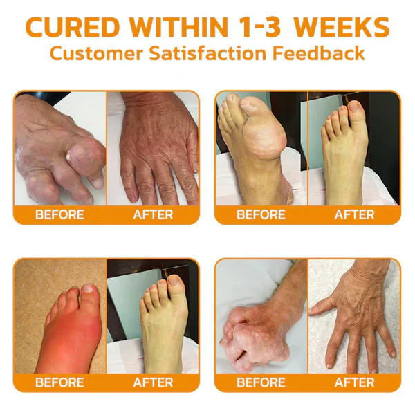 π‘Flysmusβ’ Bee Venom Pain-Relief Bone Healing Cream(Specially for older adults & TGA recommends)