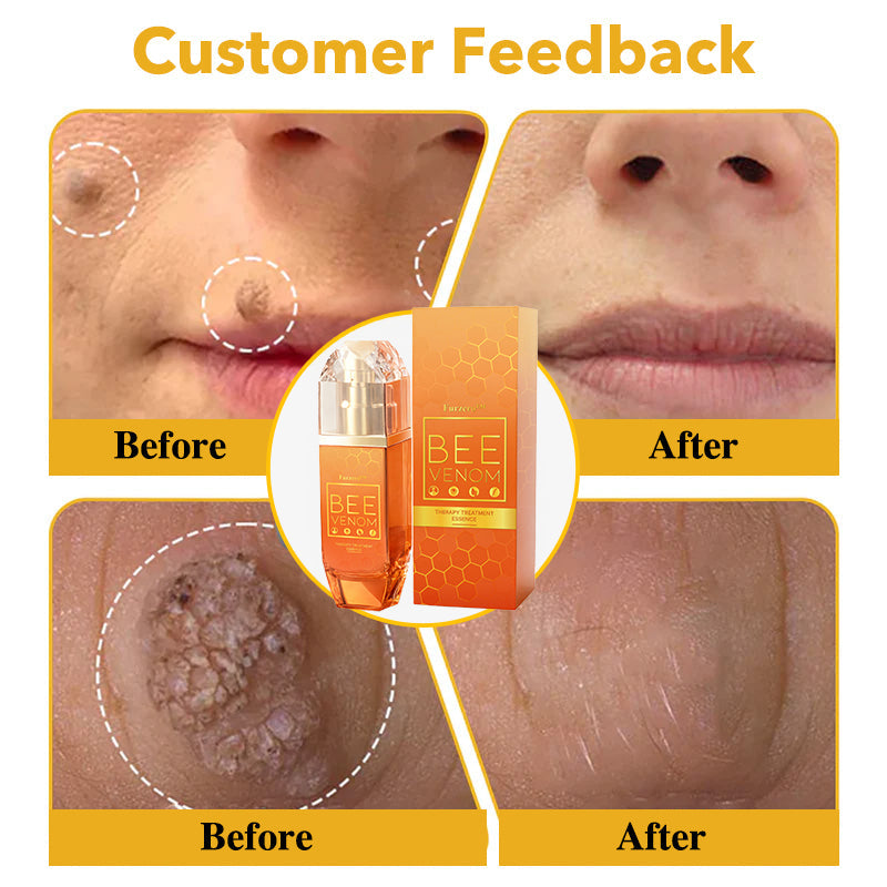 đżđFurzero⢠Bee venom Therapy Treatment Essence