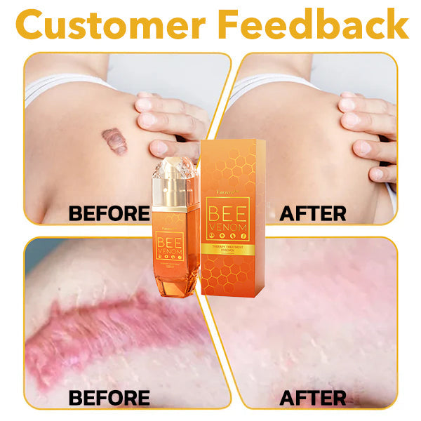 đżđFurzero⢠Bee venom Therapy Treatment Essence