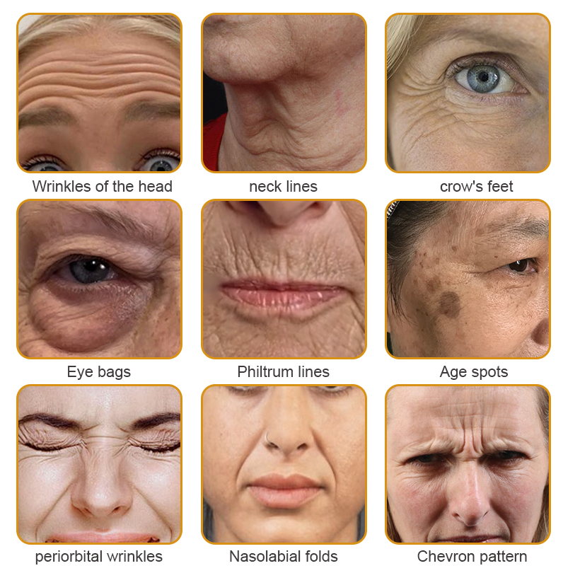🐝👩⚕️Made and Shipped from Australia✨Furzero™ Botox Bee Venom Wrinkle Removal Cream-🔥LAST DAY 70% OFF