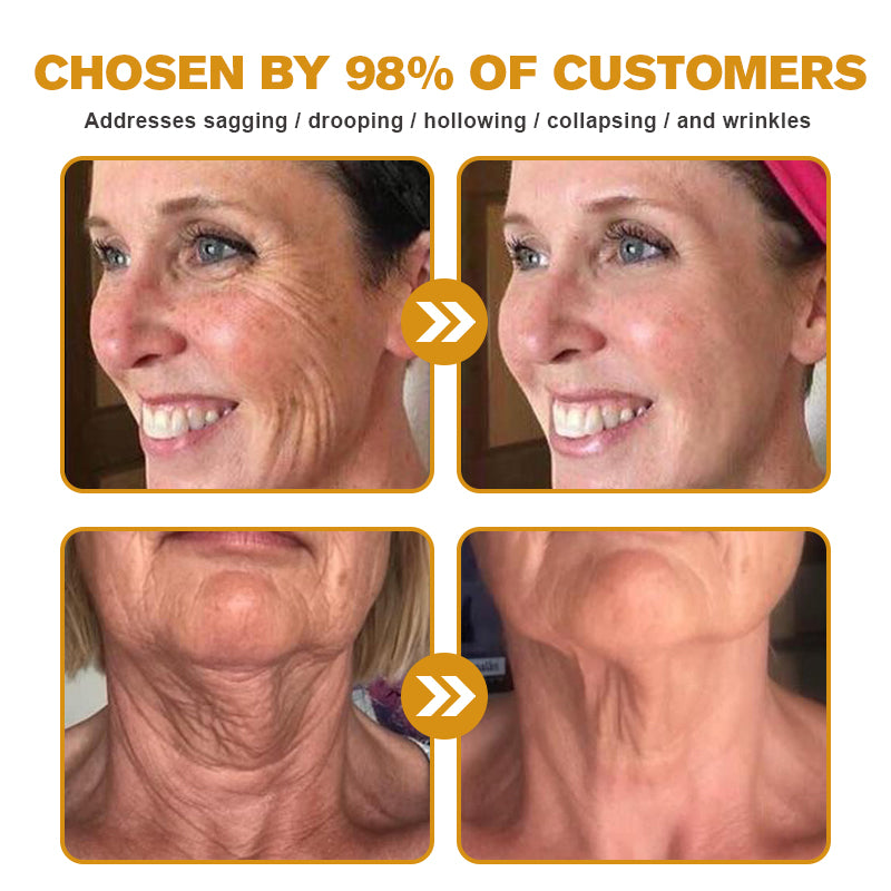 🐝👩⚕️Made and Shipped from Australia✨Furzero™ Botox Bee Venom Wrinkle Removal Cream-🔥LAST DAY 70% OFF