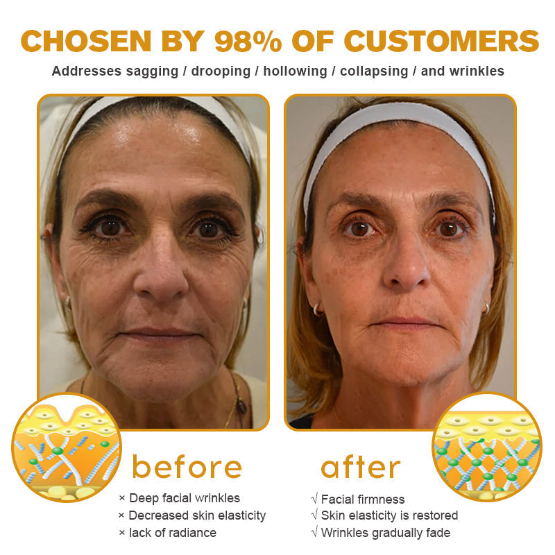 🐝👩⚕️Made and Shipped from Australia✨Furzero™ Botox Bee Venom Wrinkle Removal Cream-🔥LAST DAY 70% OFF