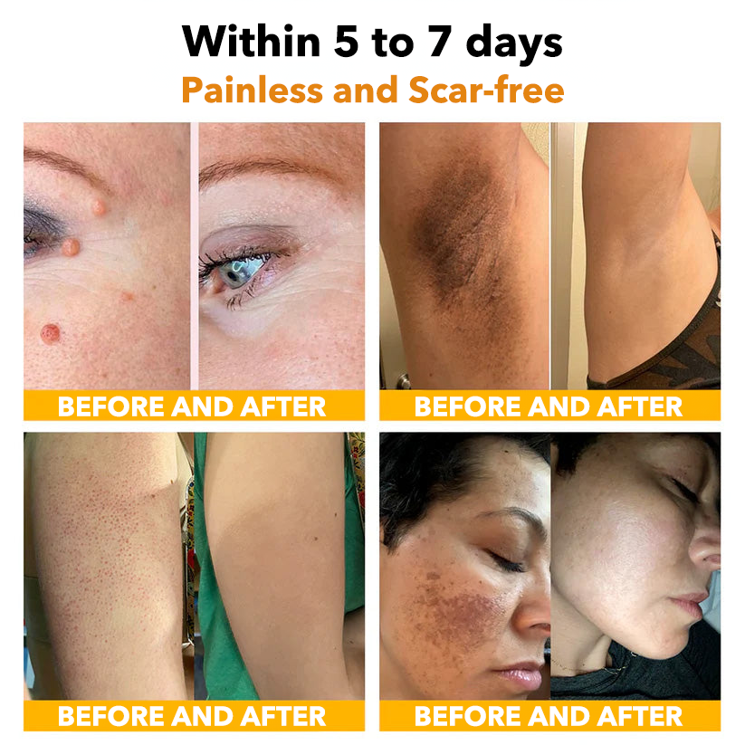 🐝Furzero™ Bee Venom Therapy Spray(✅Dermatest Certification)