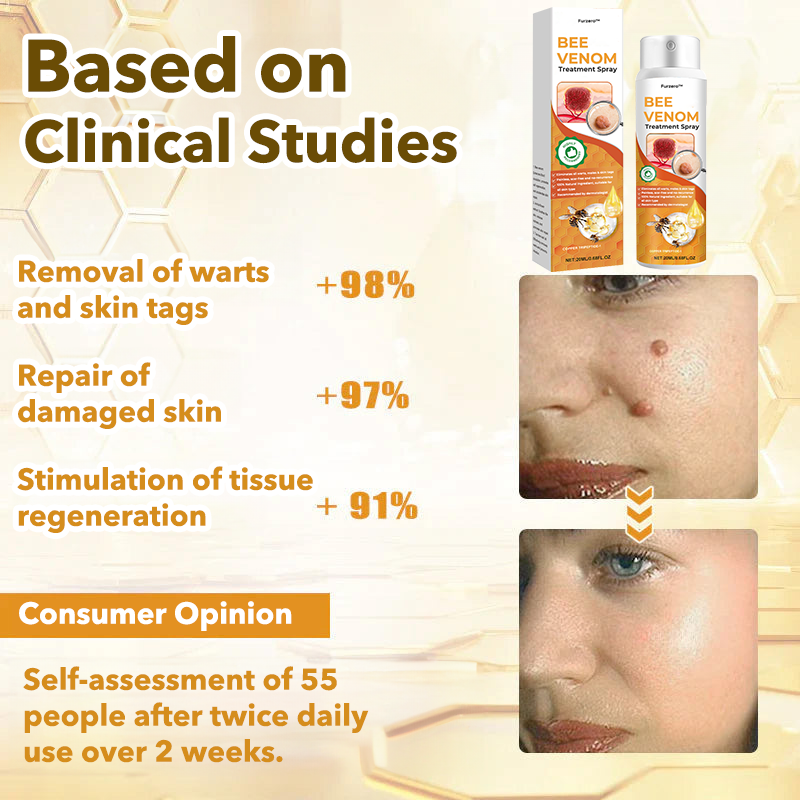 🐝Furzero™ Bee Venom Therapy Spray(✅Dermatest Certification)