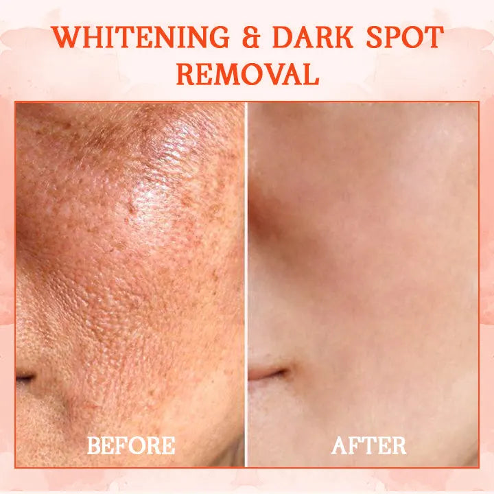 🐷💧𝐋𝐚𝐬𝐭 𝐃𝐚𝐲 𝐃𝐢𝐬𝐜𝐨𝐮𝐧𝐭: 𝟕𝟎% 𝐎𝐅𝐅 Furzero® SkinFirming Rejuvenating Cream