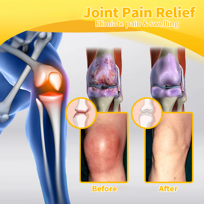 🔥Aeefeng™ Bee Venom Advanced Joint and Bone Therapy Cream (Specializes in Orthopedic Disease and Arthritis Pain)💖💖