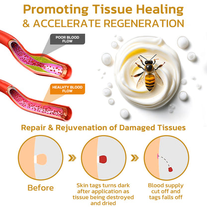 GFOUK™ TakeTag Bee Venom Therapy Cream