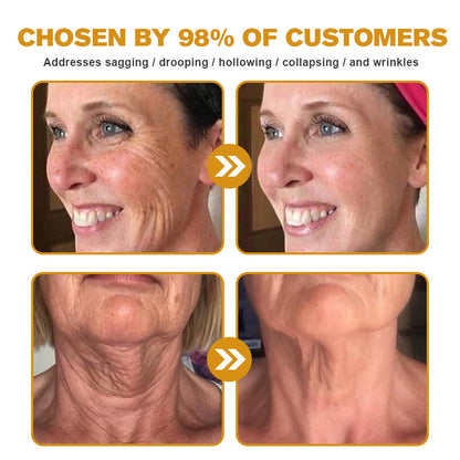 🐝👩‍⚕️Made and Shipped from Australia✨Furzero™ Botox Bee Venom Wrinkle Removal Cream-🔥LAST DAY 70% OFF
