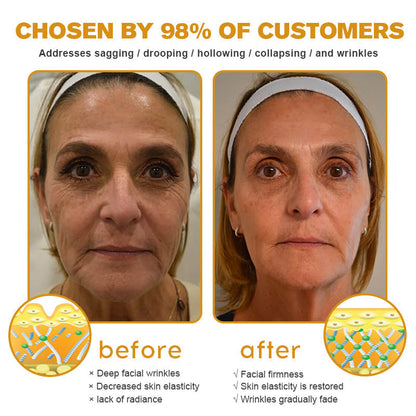 🐝👩‍⚕️Made and Shipped from Australia✨Furzero™ Botox Bee Venom Wrinkle Removal Cream-🔥LAST DAY 70% OFF